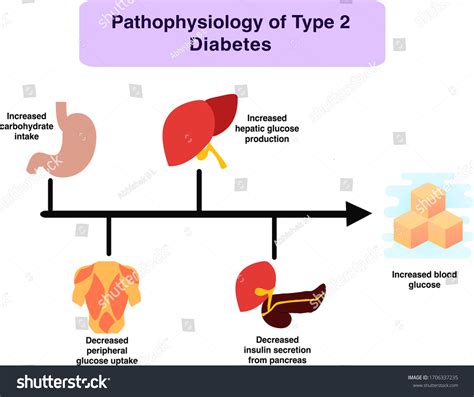 Type 2 Diabetes Pathophysiology Diagram