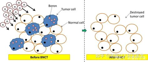 中科院引领治癌新突破，我国bnct抗癌硼药有望2023年上市 知乎