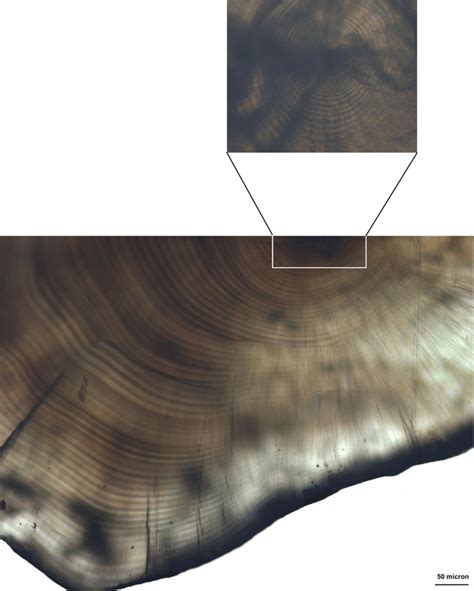 Diplodus Sargus Sargus Sagittal Otolith Microstructure Showing The