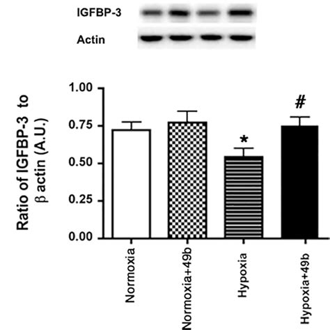 Protein Levels Of IGFBP 3 From Retinal Endothelial Cells Cultured In