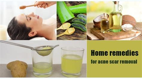 Home remedies for acne scar removal | by Tentaran Health | Medium