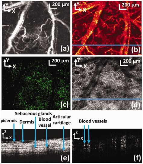 Integrating Photoacoustic Microscopy With Other Imaging Technologies