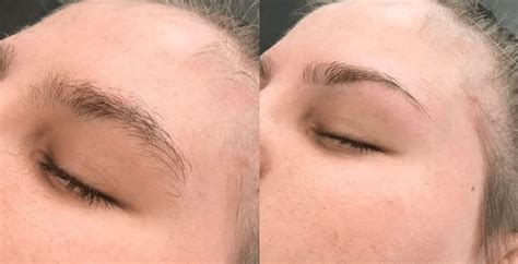 Eyebrow Threading Before And After