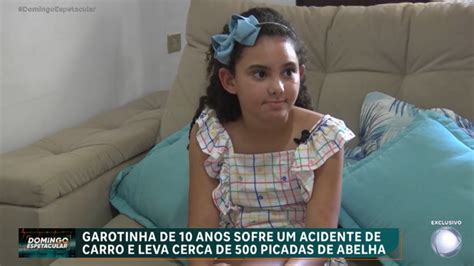 Veja como está a menina de 10 anos que sobreviveu a um acidente grave e