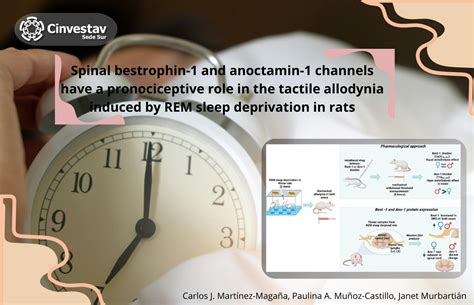 Dra Janet Murtabián Spinal bestrophin 1 and anoctamin 1 channels have