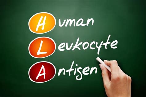 Human Leukocyte Antigen System Likely Plays a Role in Course of HBV ...