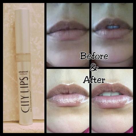 City Lips Before And After Photos City Cosmetics Pinterest