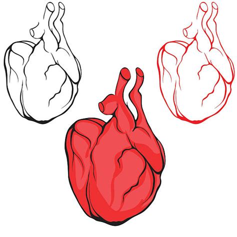 Heart Transplant Clip Art Illustrations Royalty Free Vector Graphics