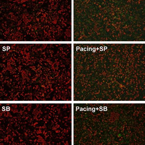 Mitochondrial Membrane Potential Assessed By JC 1 Dye Cells Were