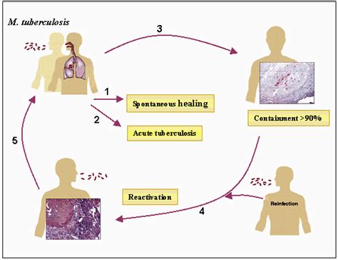 Inspired By Kaufmann Et Al Mycobacterium Tuberculosis Mtb