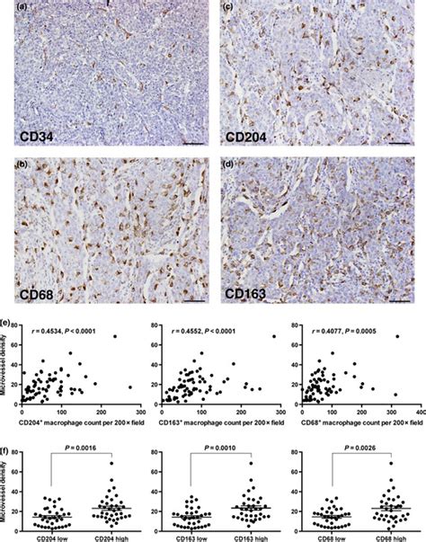 Microvessel Density MVD Showed Significant Positive Correlation With