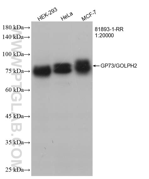 GP73 GOLPH2 Antibody 81893 1 RR Proteintech