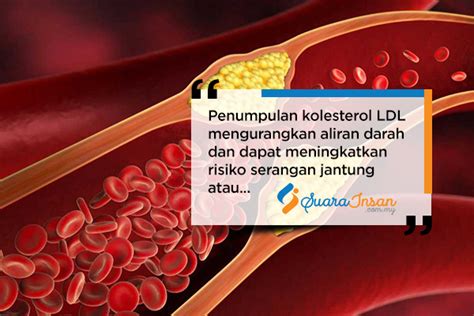 Ini Perbedaan Kolesterol Ldl Dan Hdl Serta Kisaran Angka Normalnya