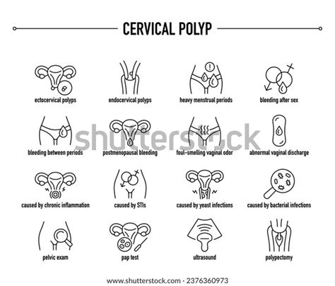 Polyps Icon Over 1 187 Royalty Free Licensable Stock Illustrations