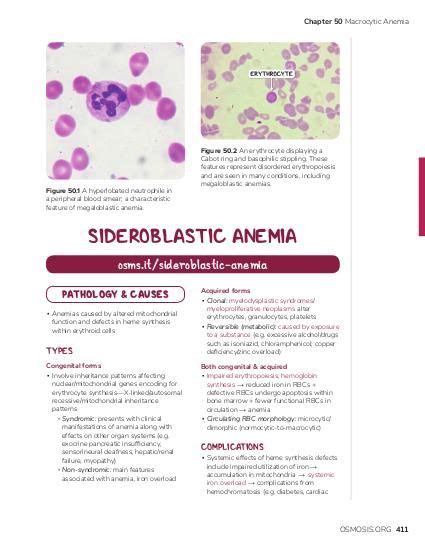 Sideroblastic Anemia Video Causes And Meaning Osmosis