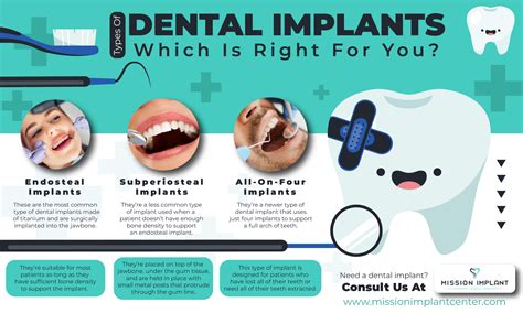 Types Of Dental Implants: Which Is Right For You ? - missionimplantcenter