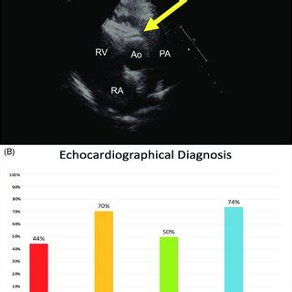 Panel A Echocardiographic Short Axis Image Showing The Aaorca