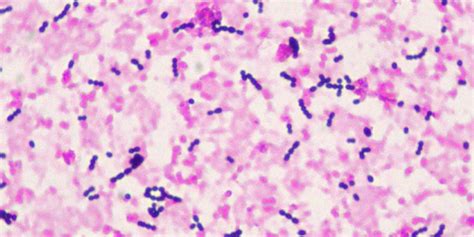 gram stain labguider