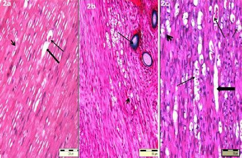 Photomicrographs Of The Sciatic Nerve In Cg At The Th Pod A