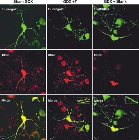 Castration Causes A Reduction Of Bdnf Protein In Proximal Snb