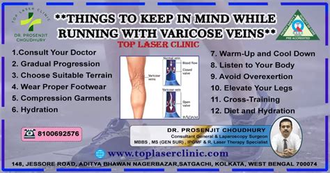 Does Running Make Varicose Veins Worse Top Laser Clinic