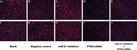 The Morphological Changes Of Sgc And Kato Iii Cells After Tgf