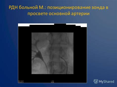 Презентация на тему: "Радиочастотная денервация почечных артерий при ...