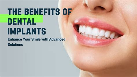 Ppt The Benefits Of Dental Implants Enhance Your Smile With Advanced