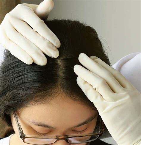 Fun Tips About How To Treat Scalp Pimples Commonlab23