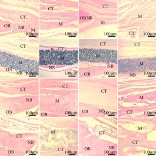 Histological Analysis In Critical Size Bone Defects CSD In Rat