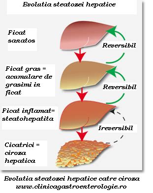 Ce dieta trebuie sa urmezi cand ai steatoza hepatica? | | Cabinet privat de gastroenterologie si ...