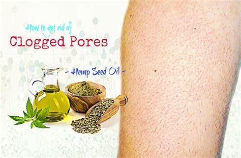 21 Tips How to Get Rid of Clogged Pores on Arms And Legs