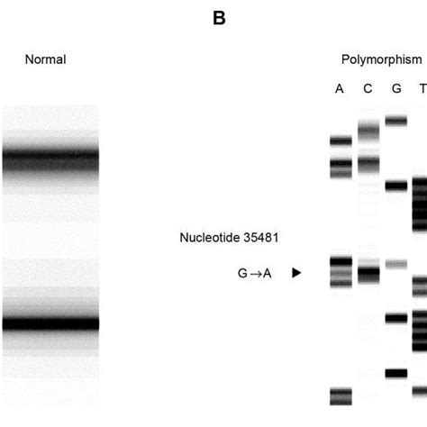 A Sscp Analysis Of The Pcr Products Derived From Primer Set 14 An