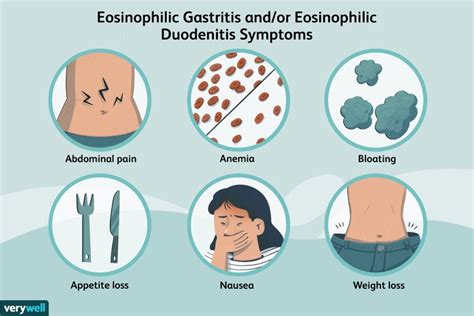 Eosinophilic Gastritis and/or Eosinophilic Duodenitis: Causes, Symptoms ...