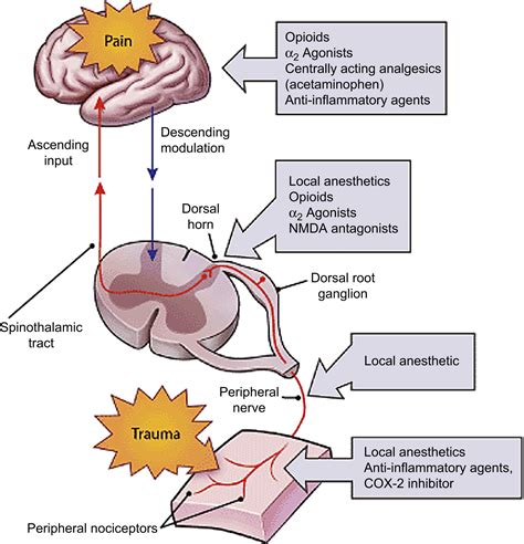 Challenges In Acute Pain Management Anesthesiology Clinics