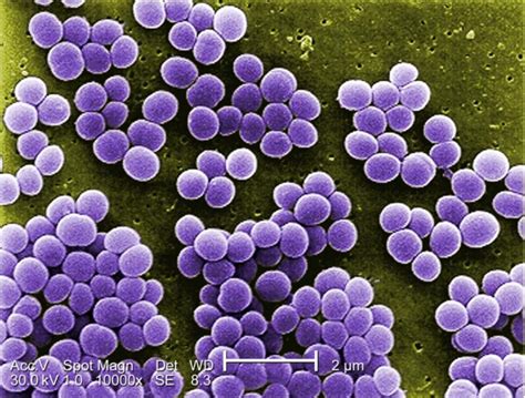 Staphylococcus | Concise Medical Knowledge