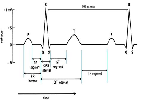 Real Time Ecg Qrs Detection