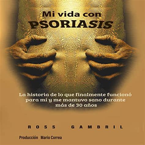 Mi Vida Con Psoriasis My Life With Psoriasis La Historia De Lo Que