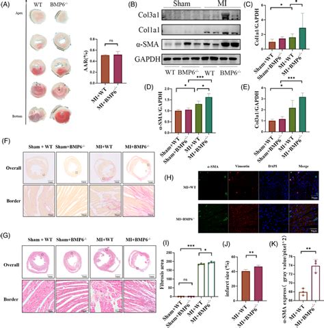 Knockout Of BMP6 Exacerbates Myocardial Fibrosis And Inflammatory