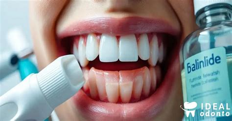 Flúor Clareia Os Dentes - Tudo sobre Aplicação de Flúor: Benefícios e Cuidados - Planos ...