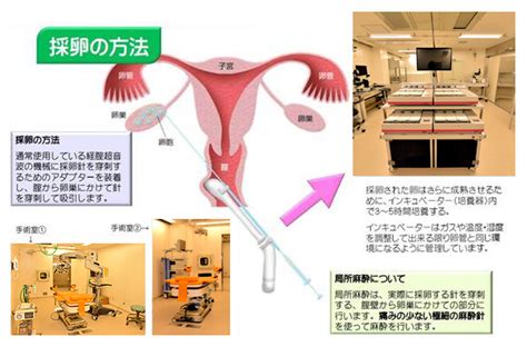 採卵 不妊治療 京野アートクリニック高輪（東京 港区 品川）