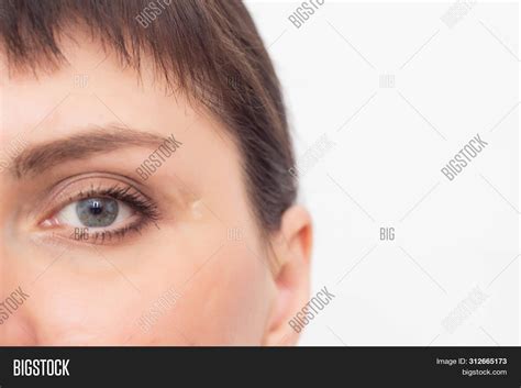 Imagen Y Foto Beautiful Girl Scar Prueba Gratis Bigstock