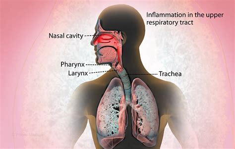 Health Condition Symptoms Causes Treatment And More