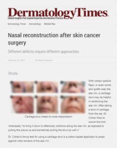 Nasal Reconstruction After Skin Cancer Surgery Dr Cohen Provides