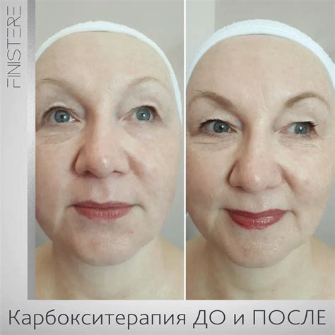 Косметика Finistere (Финистер) - отзывы косметологов