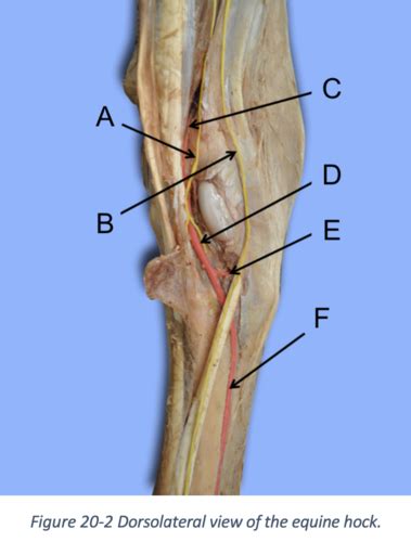 Gross Anatomy Ii Lab Quiz Flashcards Quizlet