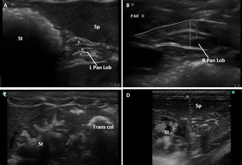 SciELO Brasil Abdominal B Mode And Doppler Ultrasonography Of