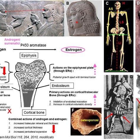 Pdf Habitus Eunucoide E Fenotipi Clinici Eunucoidi