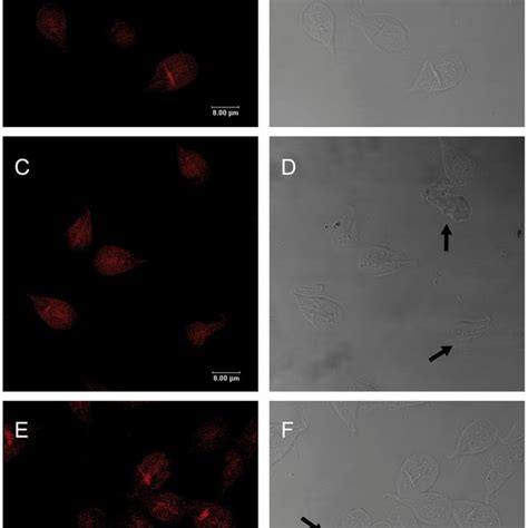 Localization Of Actin In Giardia Lamblia Trophozoites And Cysts The Download Scientific