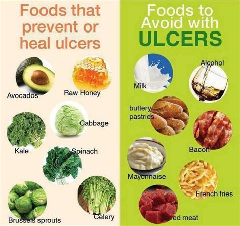 Ulcers The Best Foods Gastritis Diet Foods For Ulcers Ulcer Diet